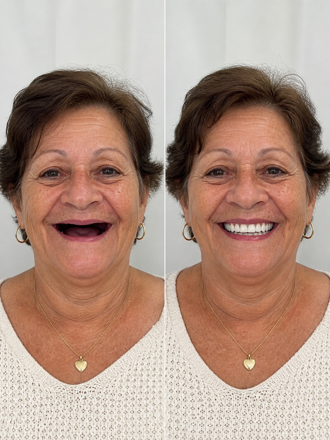 Transformação de paciente — sorriso planejado